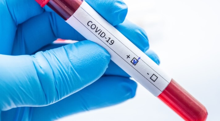 Новите случаи на заразени с коронавирус у нас са 457